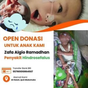 Anak Penderita Hidrosefalus di Mukomuko Butuh Uluran Tangan Dermawan